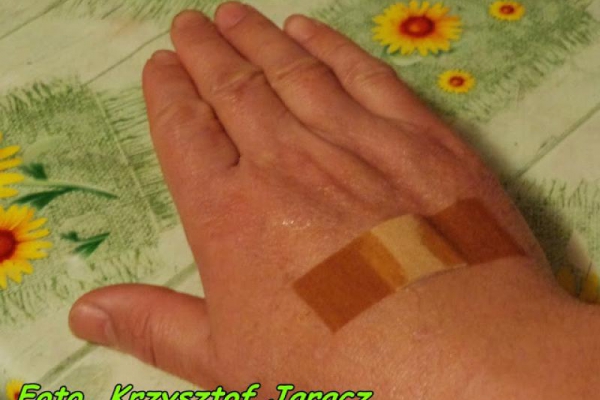 Jak łatwiej oderwać plaster opatrunkowy.