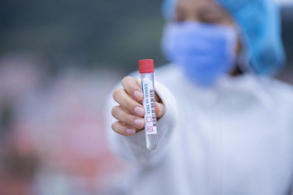 Hiszpania opracowuje szybki test na Covid-19, który da wynik w ciągu kilku sekund i pozwoli uniknąć fałszywie dodatnich wyników